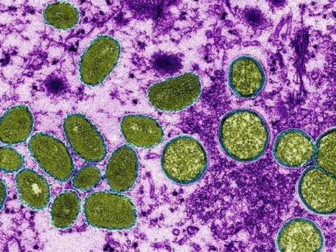 WHO đề xuất khẩn cấp đổi tên bệnh đậu mùa khỉ