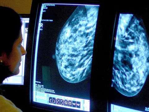 Phát triển thành công thiết bị mới có khả năng dò khối u ở người