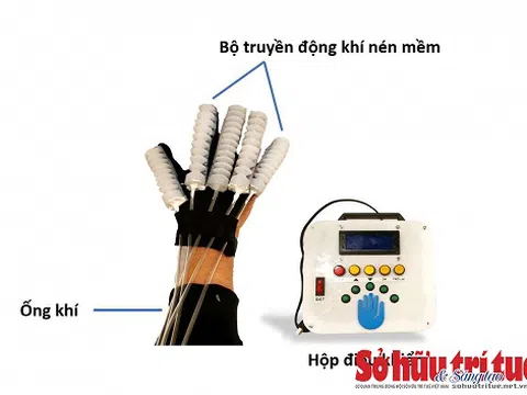 Sinh viên sáng chế găng tay thông minh phục hồi chức năng giá mềm